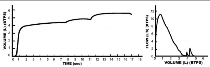 Time Volume Chart